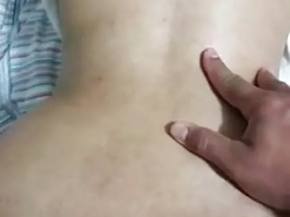 Ni furo prolapse aya, iyawo ká kẹtẹkẹtẹ.